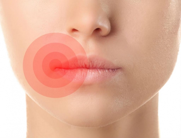 Заболеванию красной каймы губ как индикатор общего состояния организма.