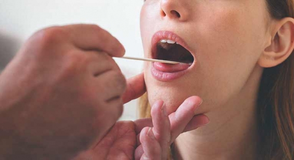 Протоколы ведения  пациентов  с заболеваниями слизистой оболочки рта